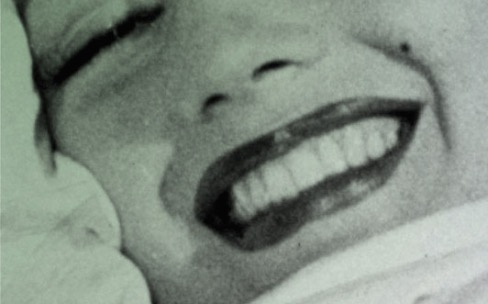 image accroche